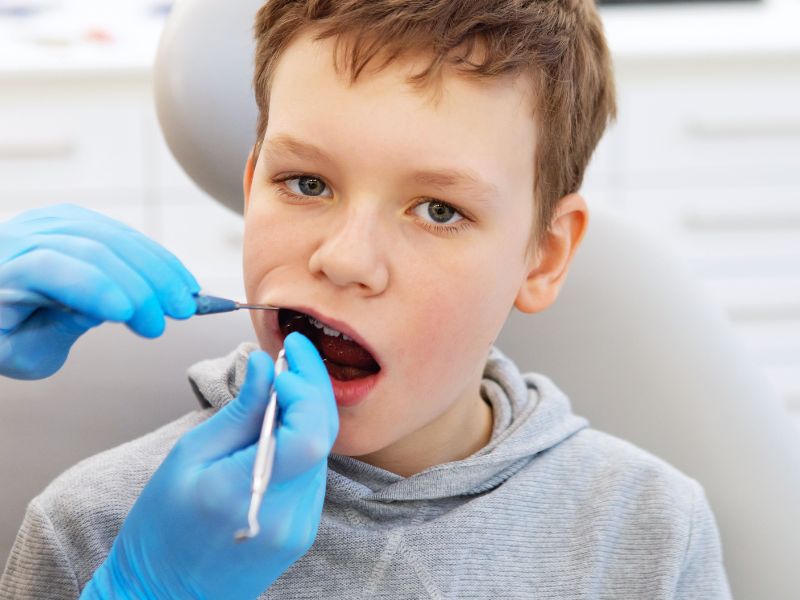 niño en el dentista: caries en niños