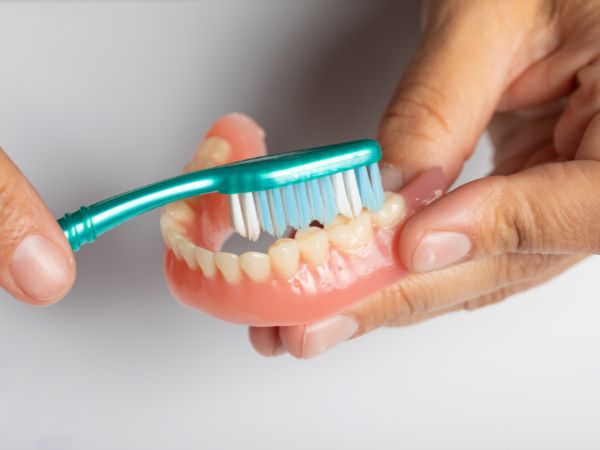Prótesis dentales removibles