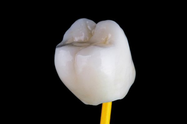 caries bajo coronas