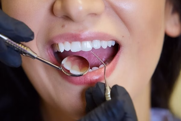 Preservación alveolar